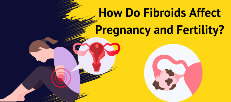 Fibroids Affect Pregnancy and Fertility