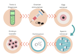 In Vitro Fertilization Process