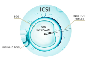 ICSI Procedure