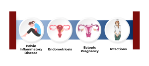 Causes of Blocked Fallopian Tubes