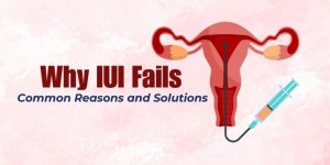 IUI Treatment