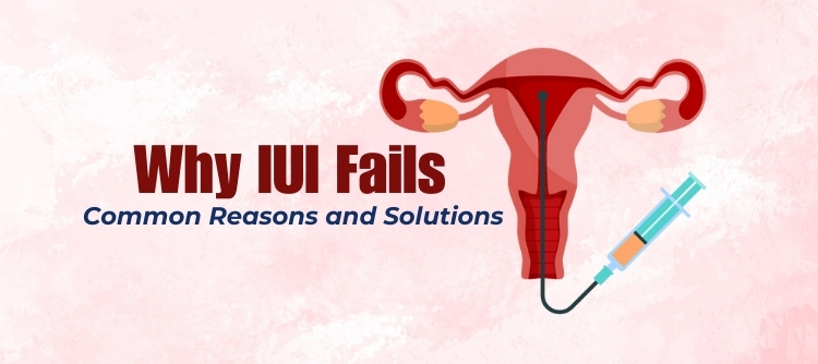 IUI Treatment