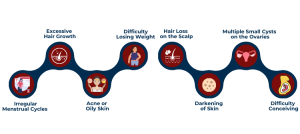 What are the symptoms of PCOS?