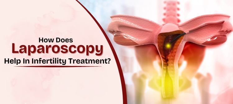 Laparoscopy Treatment