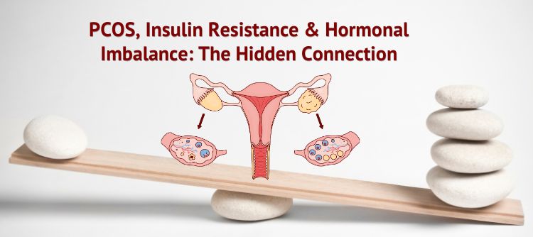 PCOS Hidden Connection